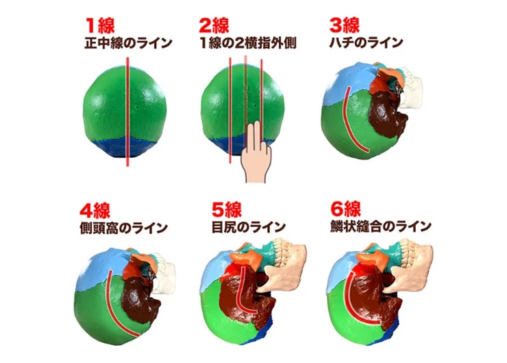 特典の縦6ラインの図解。頭蓋骨模型上の6つのラインを示している